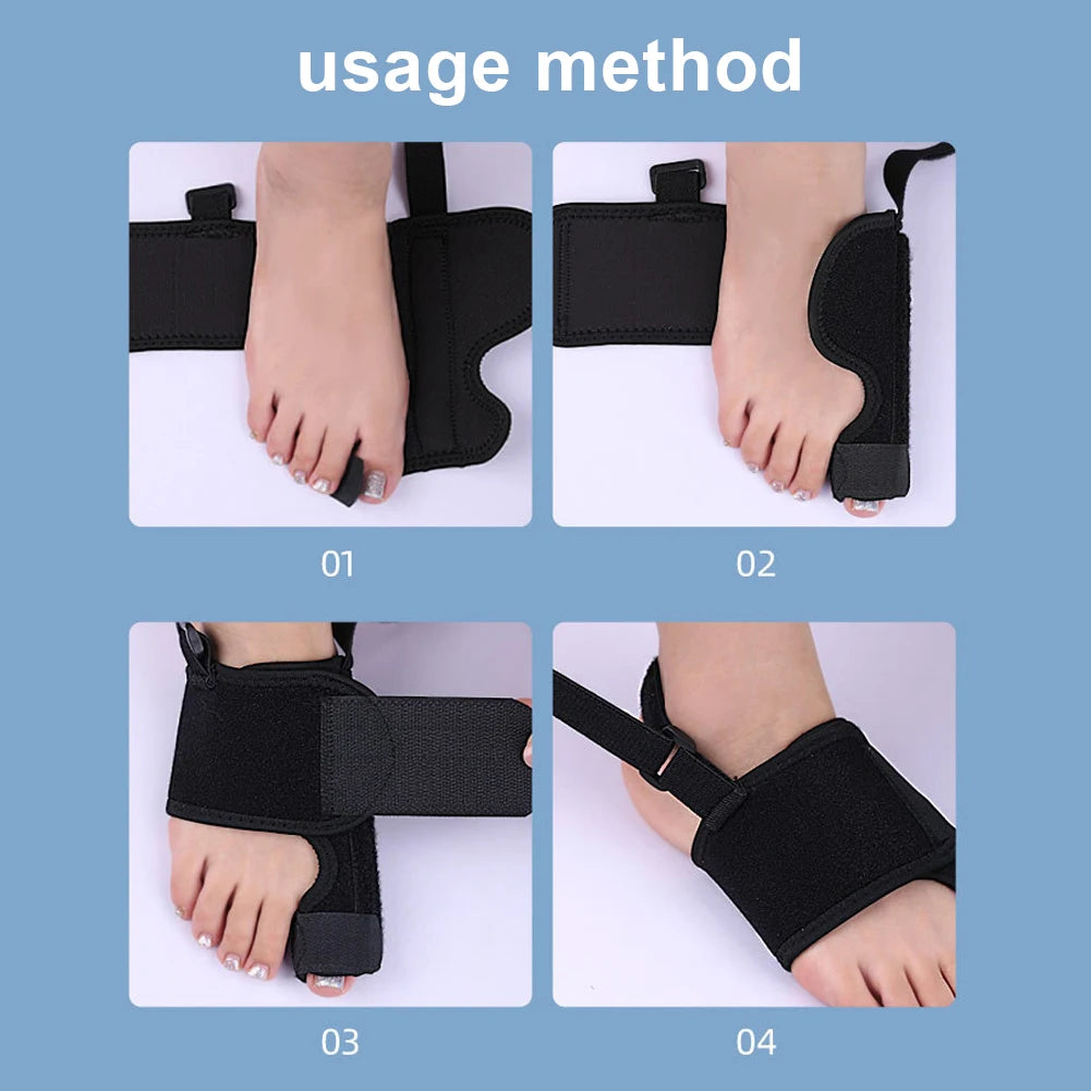 Hallux Valgus Bunion Corrector — Adjustable Toe Straightener & Orthopedic Brace