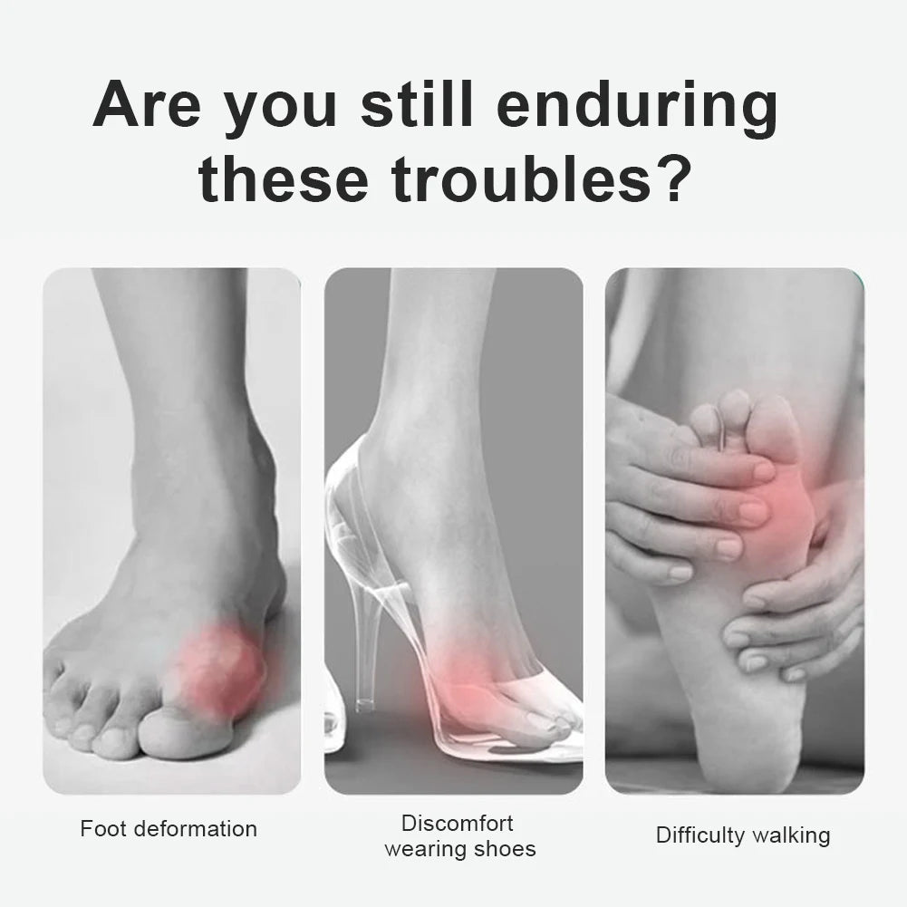 Hallux Valgus Bunion Corrector — Adjustable Toe Straightener & Orthopedic Brace